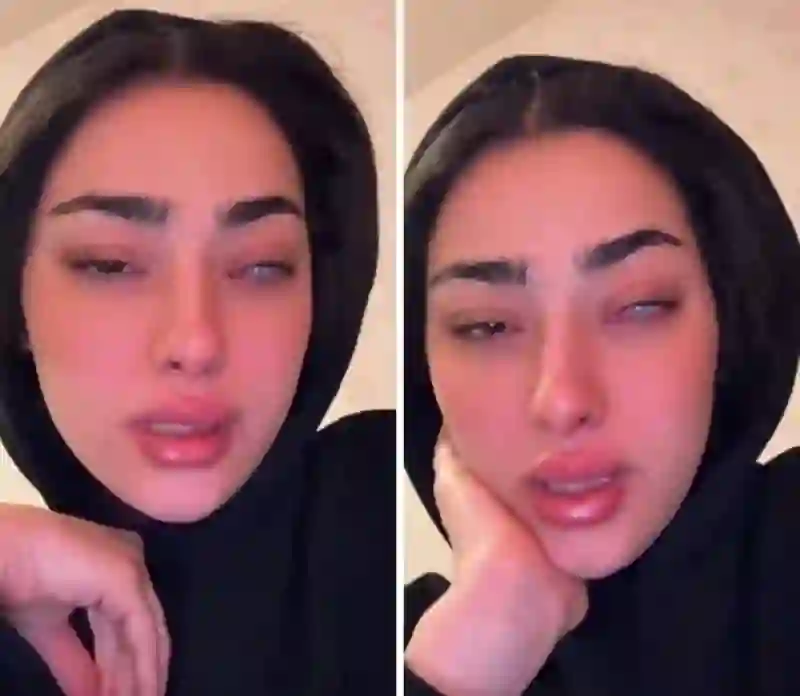 فيديو عدسات لاصقة من هذا النوع سببت العمى لفتاة في السعودية وتحذير عاجل من استخدامها 